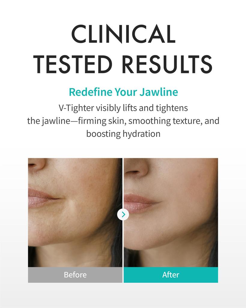 REJURAN Perfect Mask X 4 Original Collagen Sheet Mask for Facial Firmness and Sagging [Official] V-Titer (20g Sheets) c-PDRN