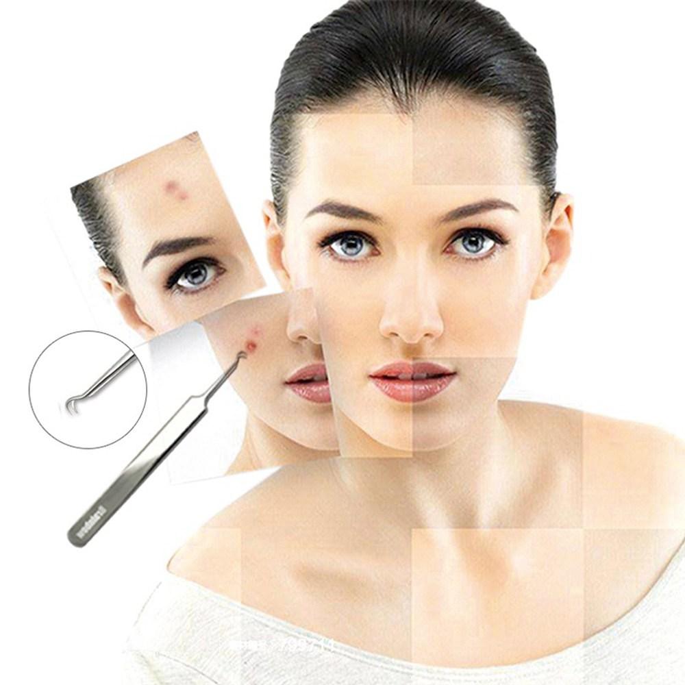 Pensetă pentru puncte negre Brain Bow 3 & Extractor de comedoane cu vârf curbat pentru imperfecțiuni, Îngrijirea pielii, 01 Argintiu, 1 bucată