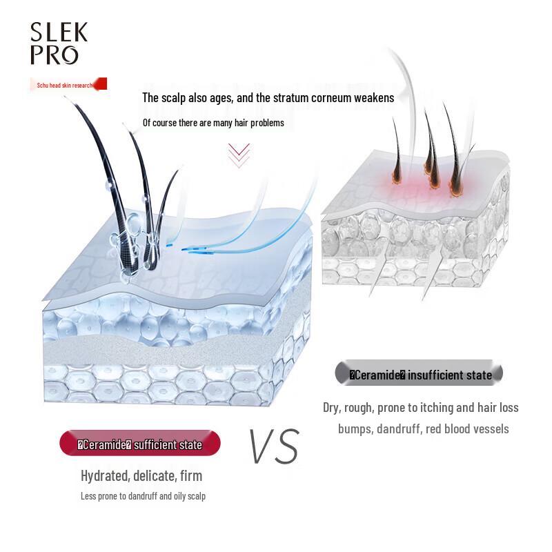 Shulei Scalp Refreshing Oil Control Anti-dandruff Shampoo