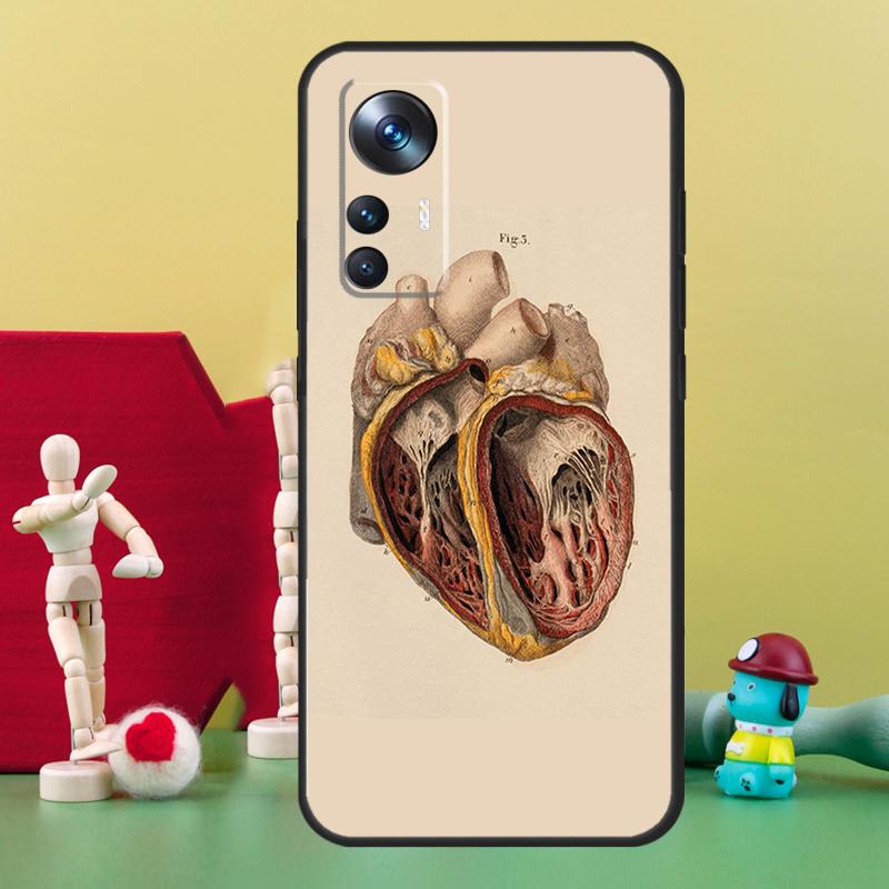 Medical Human Anatomy Case For POCO F5 Pro M4 M5 X3 X4 X5 F3 F4 GT Cover For Xiaomi 12T 11T Pro 11 12 13 Lite