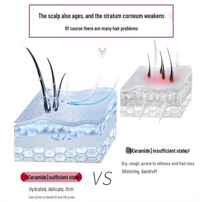 SULEI PRO Series Scalp Refreshing Oil Control Anti-dandruff Shampoo