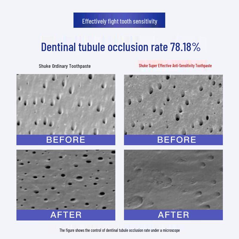 Shuke Anti-Sensitivity & Gum Care Toothpaste