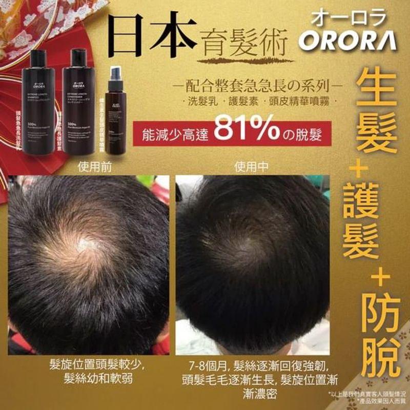 ORORA - Extreme Length & Anti Hair Loss Shampoo