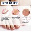 Toenail Correction Patch,  Ingrown Toenails Treatment Sticker - Toe Correction Sticker