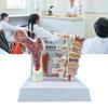 Menschliche Anatomie Osteoporose Modell Wirbel Anatomisches Skelettmodell für Medizinstudenten Lehrdemonstration