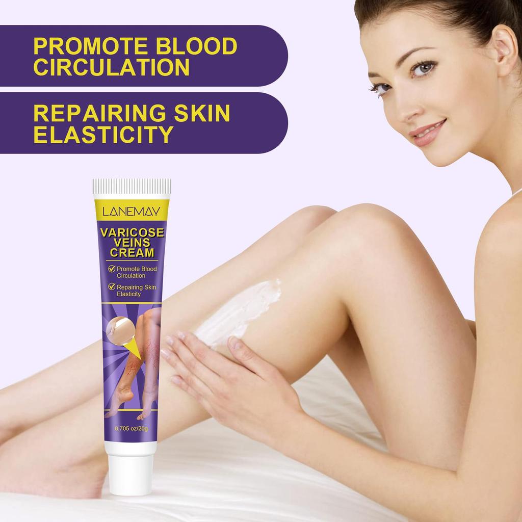 Varicose Veins Cream-Relief Phlebitis Angiitis-Promote Blood Circulation-Repair Skin Elasticity-Suitable For All Skin Types, 20g