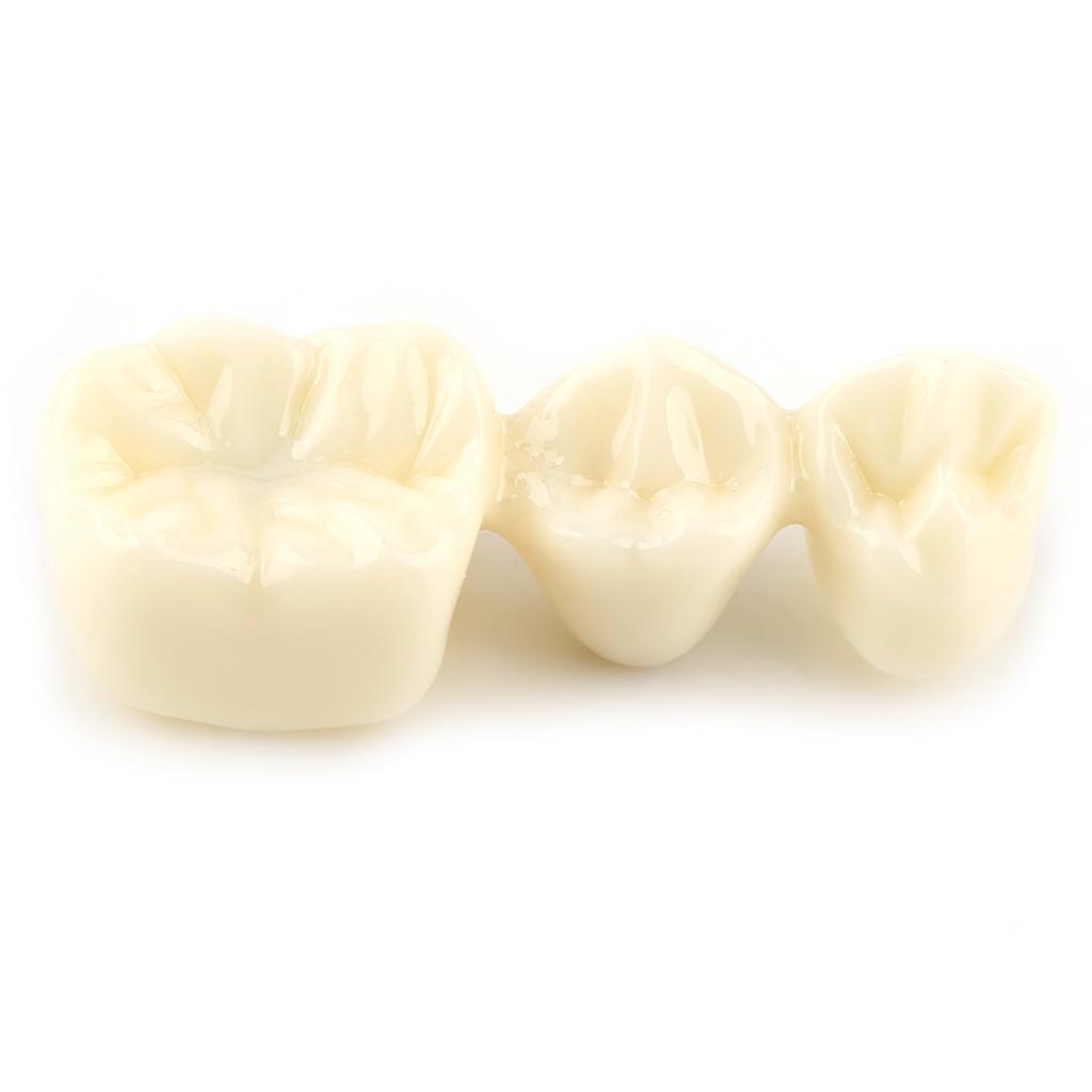 1pc Resin Dental Demonstration Tooth Model Implant Analysis Crown Bridge for Dentist