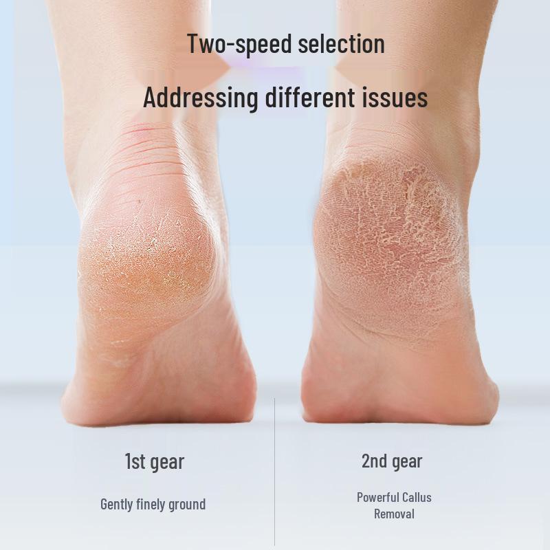 Portable Electric Waterproof Foot File & Callus Remover with LCD Display for Home Pedicures