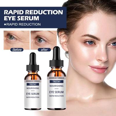 Eye Cream Remove Eye Bags Puffiness Dark Circles Whitening Moisturizing Eyes Skin Care Face Care