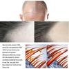 Schnelles Haarwachstum Serum Spray Gegen Haarausfall Vorbeugung von Kahlheit Kopfhautbehandlung Reparatur der Wurzeln Schönheit Gesundheit Haarpflege Für Männer Frauen