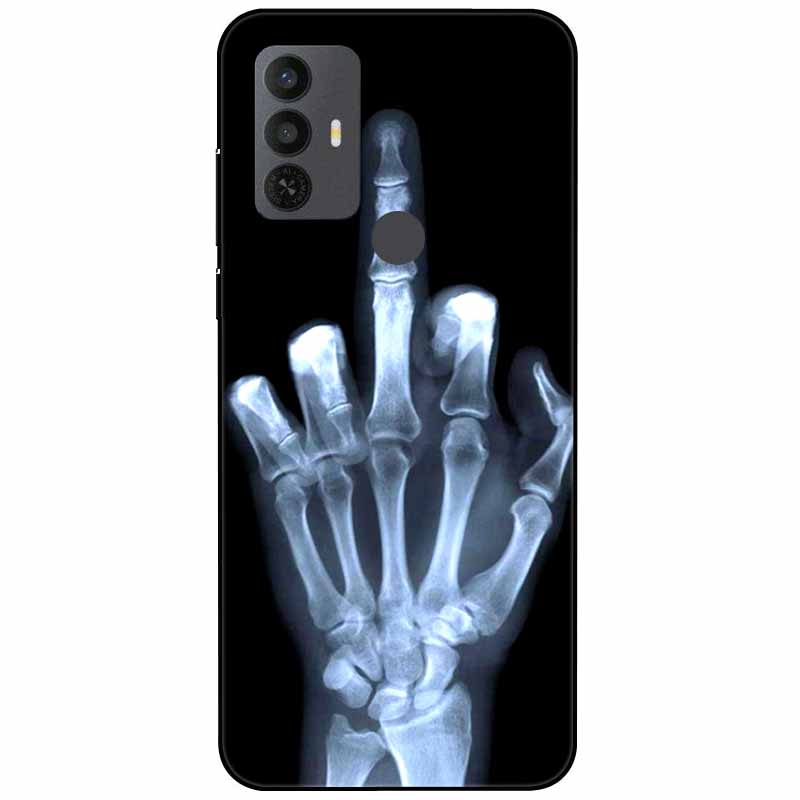 Für TCL 30 SE Hülle 305 6.52'' Silikon Weich Mode TPU Handyhülle für TCL 305 306 30SE Hülle 6165A Bumper Funda für TCL30SE 405