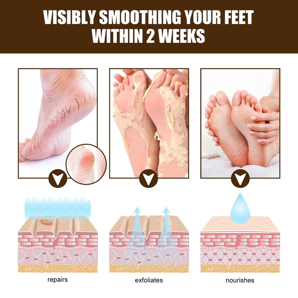 15g Cracked Heel Treatment Cream Repairing Feet Anti-Dry Cracked Peeling Chapped Moisturizing Foot Cream