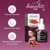 EELHOE Begonia Facial Oil Fades Acne Marks, Lightens Lines, Moisturizes & Firms Skin Essential Oil