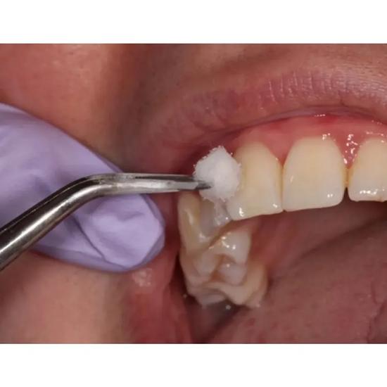 Pensetă autoblocantă GDC - Premium (Dp18l)