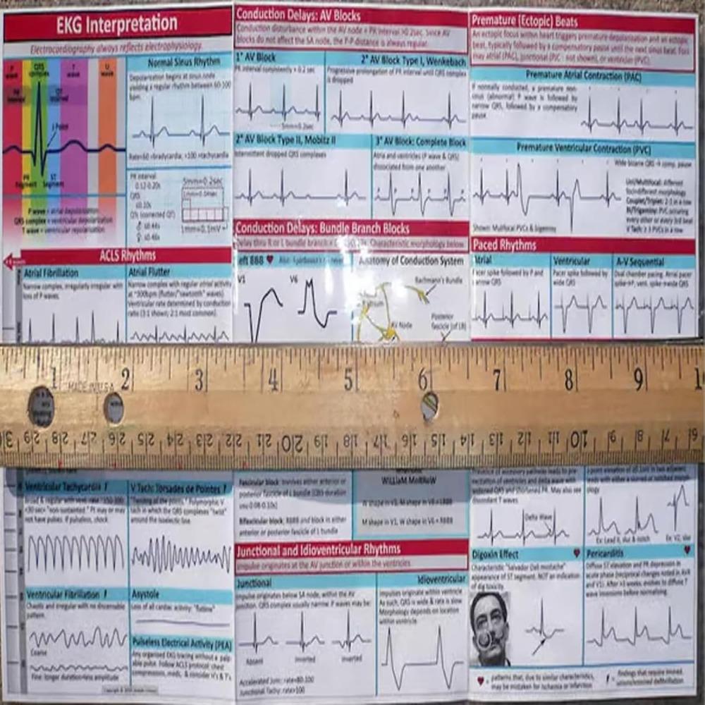 EKG Pocket Guide EKG Rhythm Interpretation Compact Portable Reference Card Rapid Interpretation EKG Pocket Nurses Gui