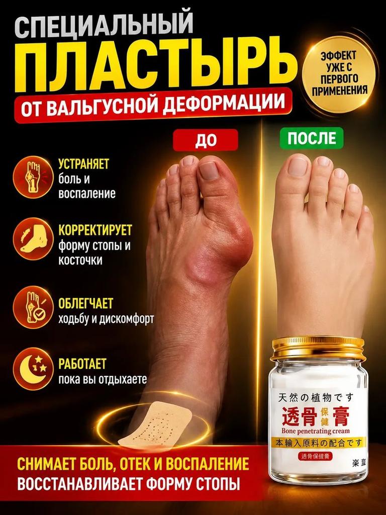 Valgomed gel with valgus deformation