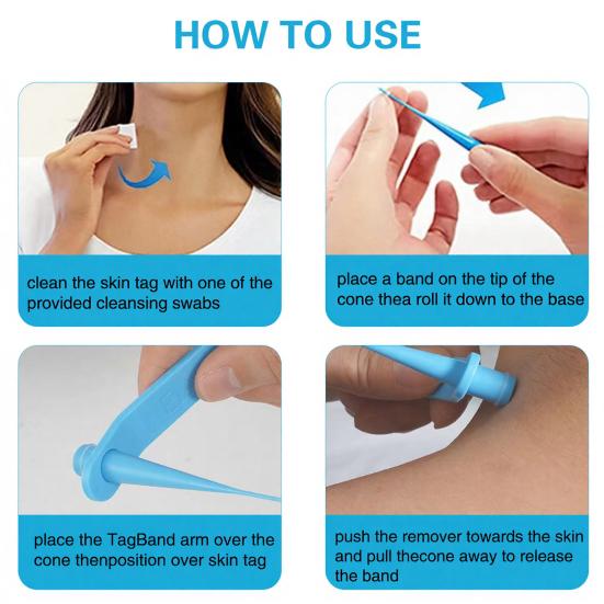 Skin Tag Remover One Hand User Friendly Home Use Safe Effective Skin Tag Removal Device Personal Care Kit