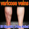 Varicose Veins Soothing Cream, Thai Technique, for Bloodshot Leg Floating, Itching
