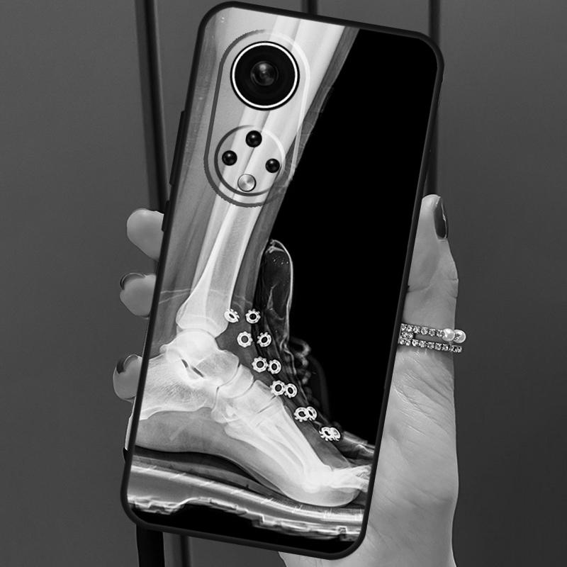 

Рентгеновская анатомия человека для Huawei P20 P30 P40 Lite Pro P Smart 2019 Nova 9 5T чехол для телефона Honor 50 8X 9X 10i Mate 20 Lite