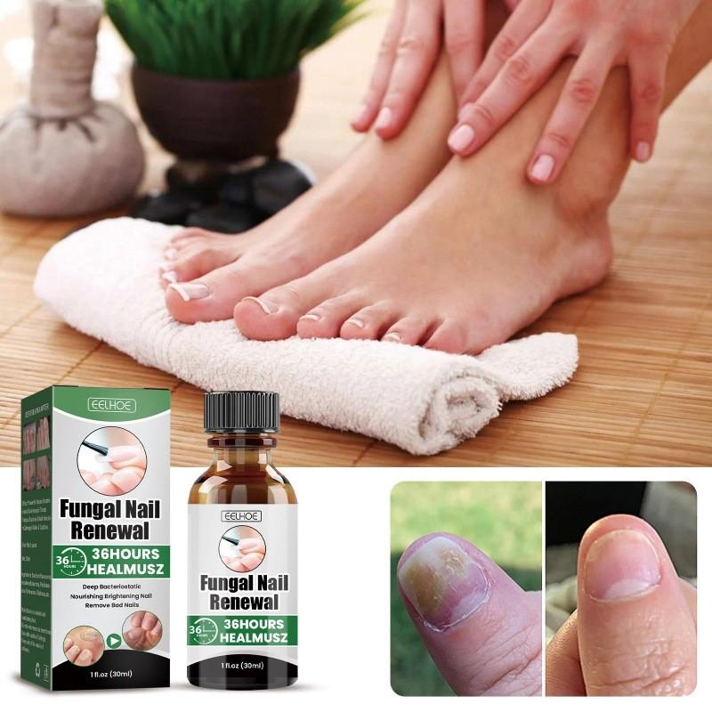 Eelhoe Nail Care Solution For Fungal Toenail Treatment With Nourishing Moisture