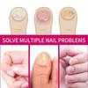 1-5x OUHOE Ingwer Nagelpflege Essenz, Graue Nägel Feuchtigkeitspflege Peeling Schönheitsnagel Essenz