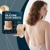 AMZ Silicone Scar Sheets, Scar Lightening, Skin Care Patches To Improve Scar Appearance, 4cm X 150cm