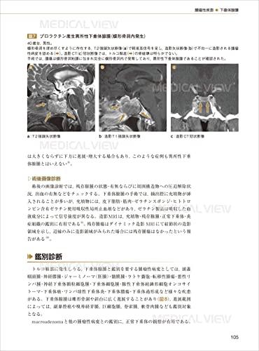 Pituitary gland imaging