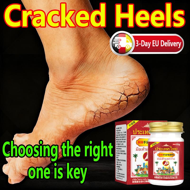 Focus on The Skin Soothing Cream for The Improvement of Dry and Itchy Feet