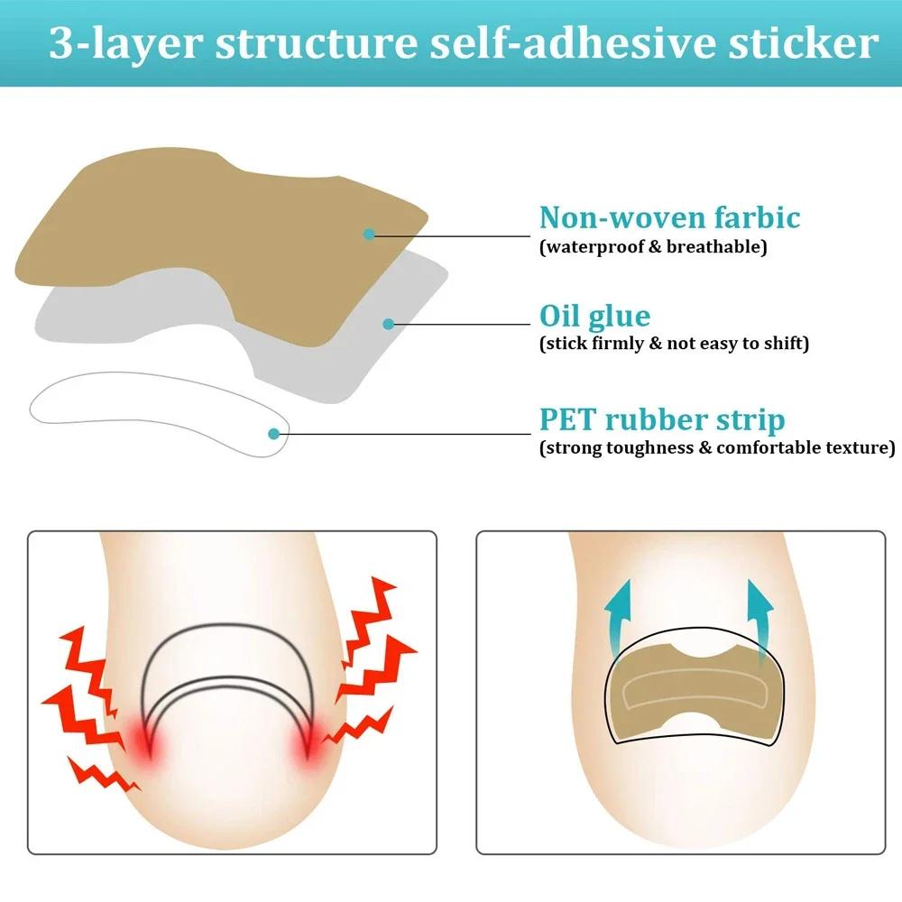 Ingrown Toenail Correction Patch Stickers Ingrown Toenail Treatment Lifter Toe Nail Patch Correction Buckle File Cuticle Pusher