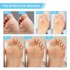 Foot Corn Removal Killer Calluses Plantar
