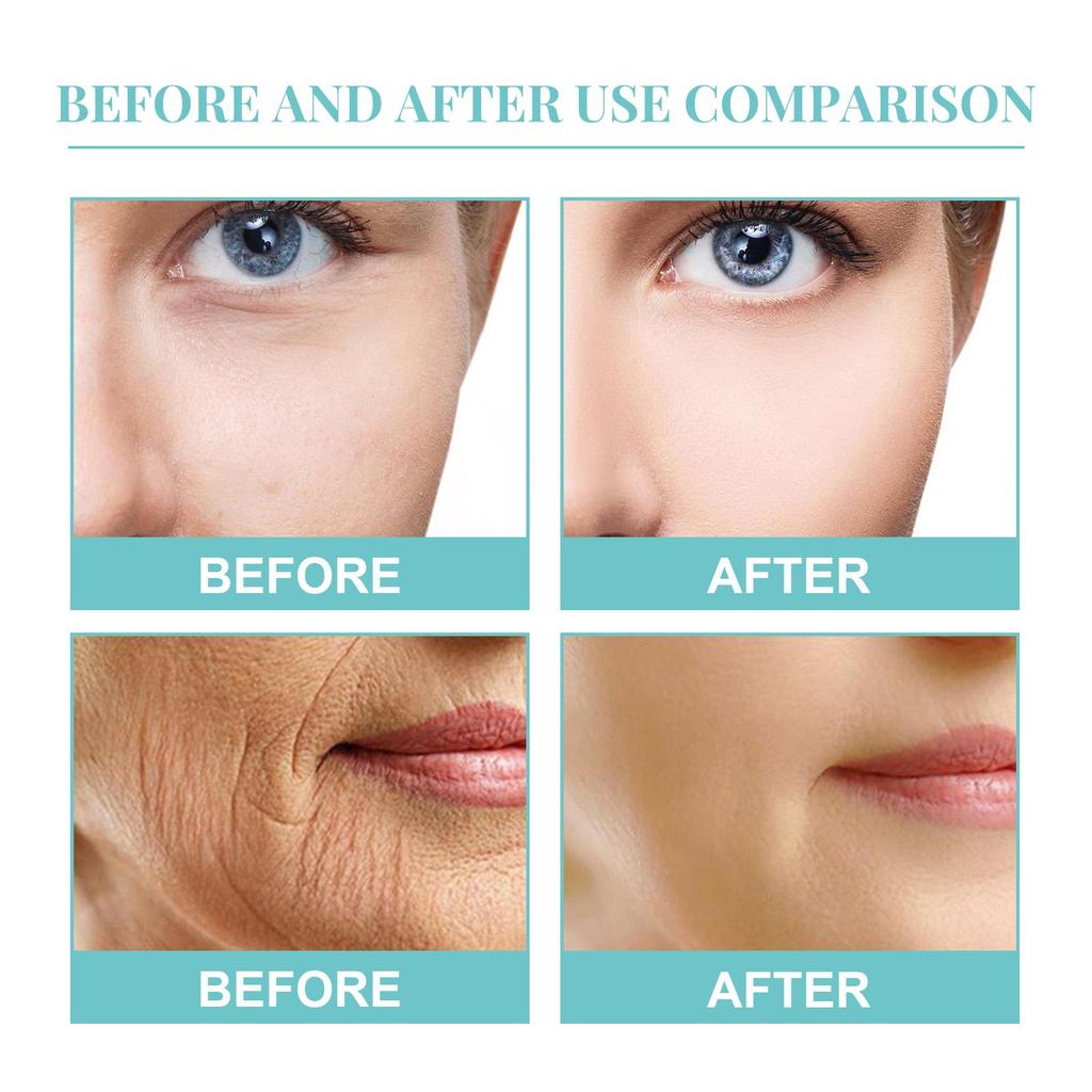 OUHOE Deep Moisturizing Anti-Wrinkle Cream, Hydrates, Brightens, Reduces Spots and Fine Lines, Suitable for the Face, 50g