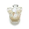 Dental Educational Model, Zamo®, Used To Exemplify Dental Pathologies, 31 Teeth, Transparent