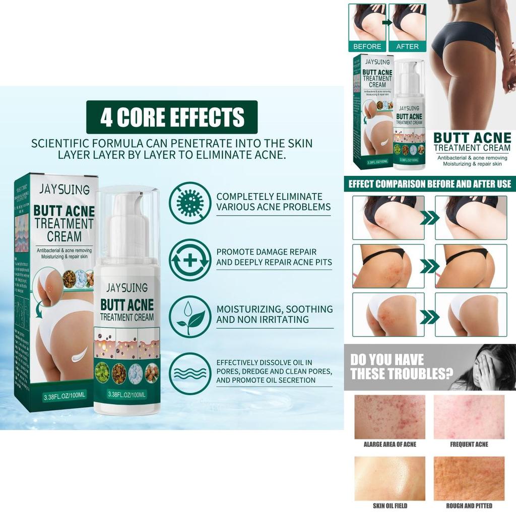 Jaysuing Butt Care Cream Nourishing Moisturizing Formula For Clear And Smooth Skin