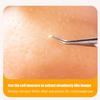 Pimple Popping Toy Silicone Facial Pimple Cleansing Toys Sensory Activities Funny for Teens Adults Students Office Home Desk