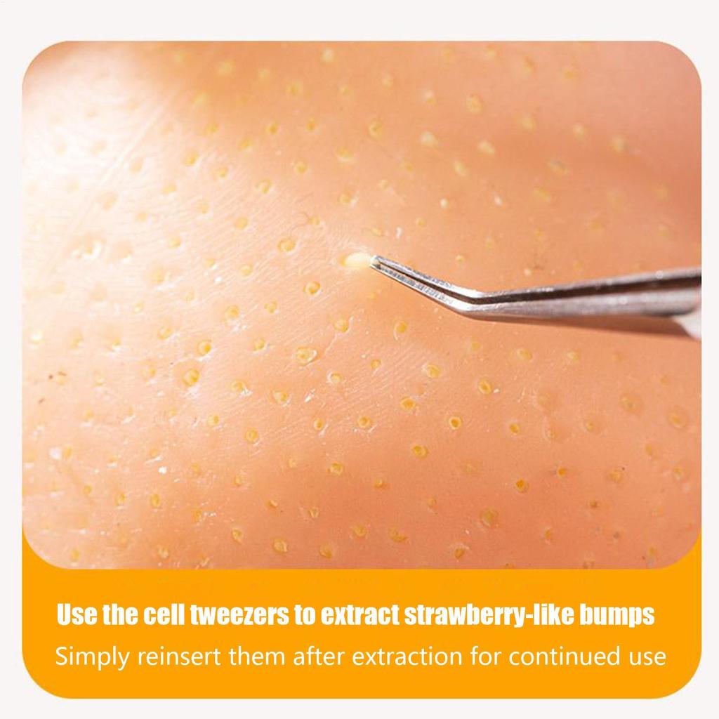 Pimple Popping Toy Silicone Facial Pimple Cleansing Toys Sensory Activities Funny for Teens Adults Students Office Home Desk