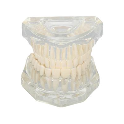 Transparent Dental Model Clear Structure Educational Dental Teeth Display Model for Dental Clinic