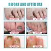 Nail Care Solution, Nail And Toe Care Solution, For Skin Care Nail Nourishing, Fungal Nail Liquid 10ml