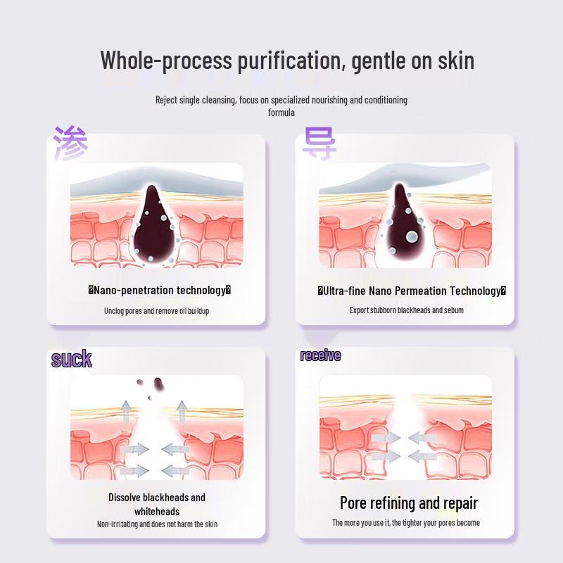 SEEDONVEUR Azelaic Acid Clay Mask for Blackhead & Pore Cleansing