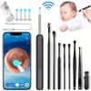 Smart Otoscope Camera Ear Cleaning Wax Wifi Hd Application Endoscope