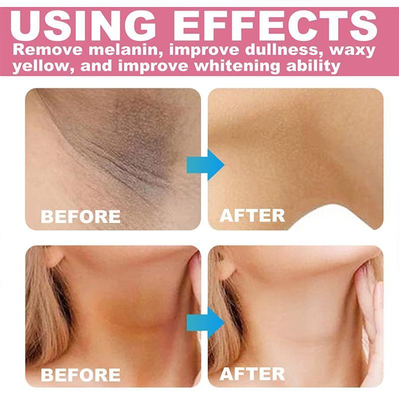 Whitening Cream, Removes , Eliminates Stubborn Spots, And Gives You A Fair And Tender Skin
