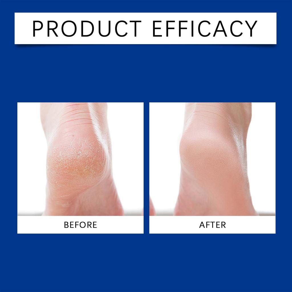 Foot Moisturizing Roller Ball Cream with Vitamin E Hydrating Soothing Cream for Cracked Heels Non Greasy Travel Friendly Gentle