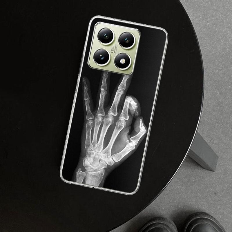Autumu X Ray Hand Bones Phone Case Cover for Xiaomi Redmi Note 15 14 13 12 11 Pro Plus 14S 12S 11S 11T 11E 10S 10 Customized Fun
