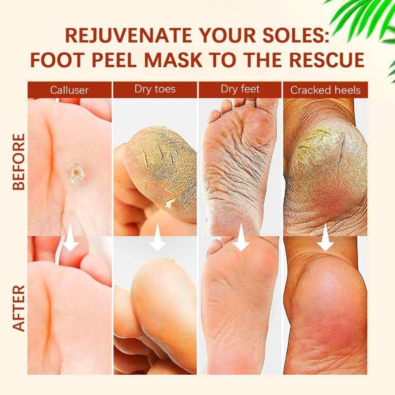 Vitamin C Orange Nourishing Foot Mask, Hydrating, Moisturizing, Removing Dead Skin, Exfoliating, Beautifying Foot Mask, Foot Mask