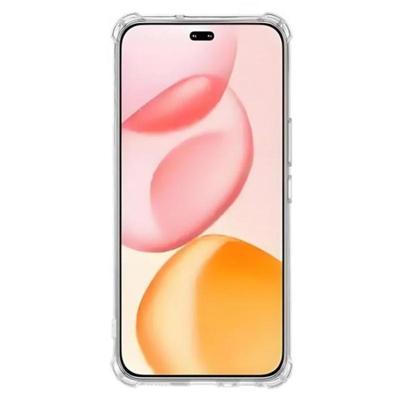 For Honor 400 Pro 5G (Global) TPU Case WANLONFENG WL3 Series 1.5mm Phone Cover with 2Pcs Tempered Glass Films