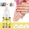 OEDO Nail Treatment Essence Oil Moisturizing Fungus Removal Foot Care Liquid