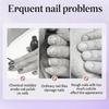 Anti-Barb Nail Cuticle Oil Moisturizing Nourishing Nail Cuticle Remover Pen Brighten Nail Care Pen