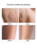Portable Electric Body Hair Remover - Unisex Razor for Intimate Areas and Underarms