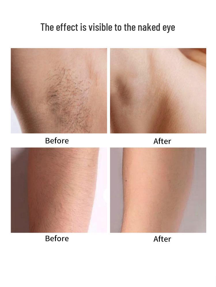 Portable Electric Body Hair Remover - Unisex Razor for Intimate Areas and Underarms