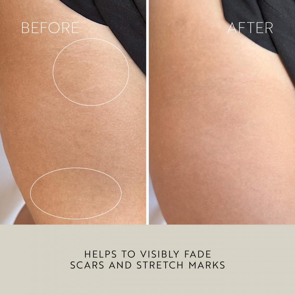 Katini Skin Firming And Hydrating Body Oil 3.4 Oz 100 Ml