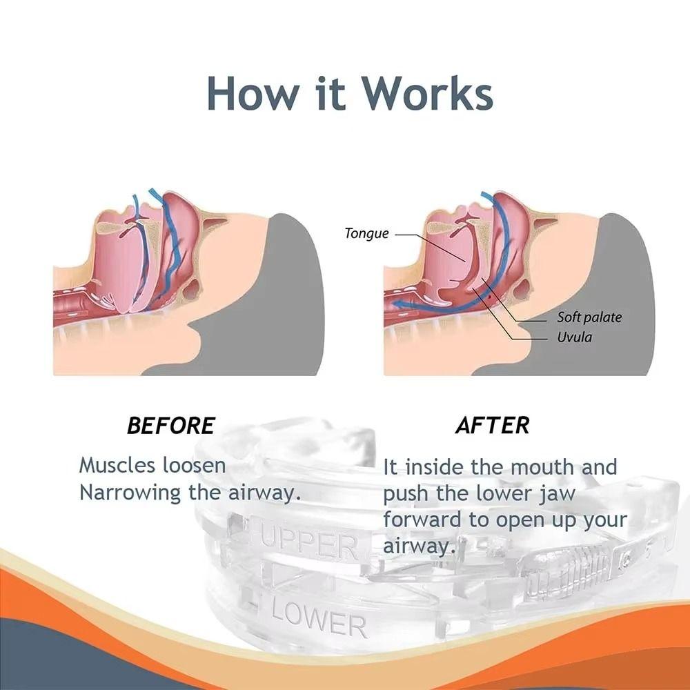 Adjustable Anti-Snoring Mouthpiece With Storage Box Snoring Mouth Guard Night Use